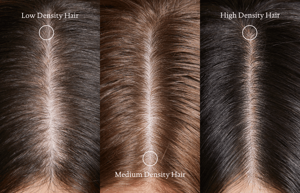 types of hair density