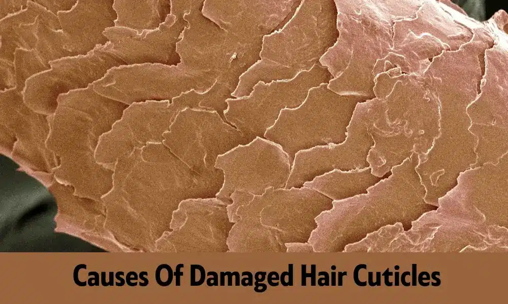 Home 5 Discover What Really Causes Damaged Hair Cuticles